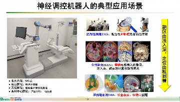 芯片自主可控，让中国脑机接口创新医疗器械研发取得新突破(图10)