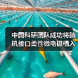 中国科研团队成功将脑机接口柔性微电极植入机器人CyberSense(图1) 中国科研团队成功将脑机接口柔性微电极植入机器人CyberSense(图1)